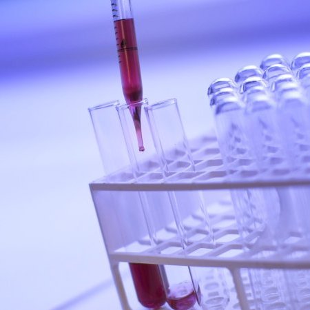 Opération de dépistage par tests antigéniques à Gargas
